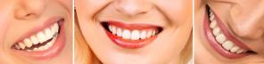 Металлокерамика: красивые и функциональные зубные протезы